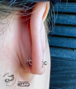 Childs-earlobe-with-unique-anatomy2